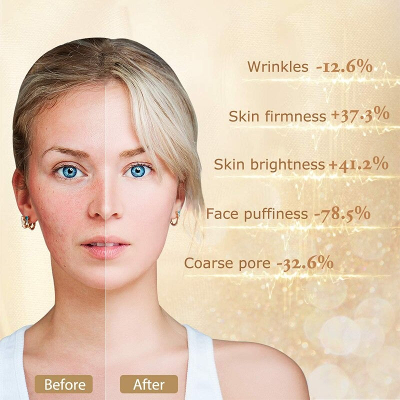 Face Wrinkle Removal Roller